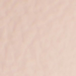 Sassari Swollen Feet After Wearing High Heels